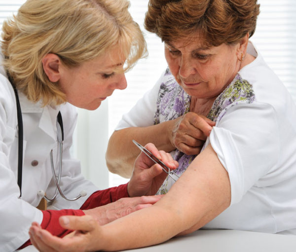 Doctor examining woman for ticks.